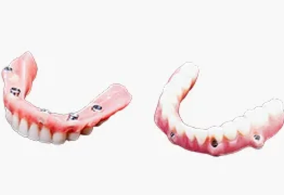 マグネットデンチャー